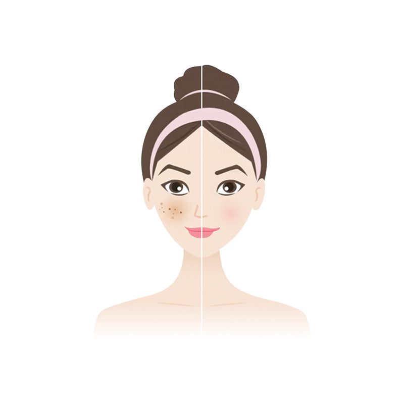 DULL SKIN