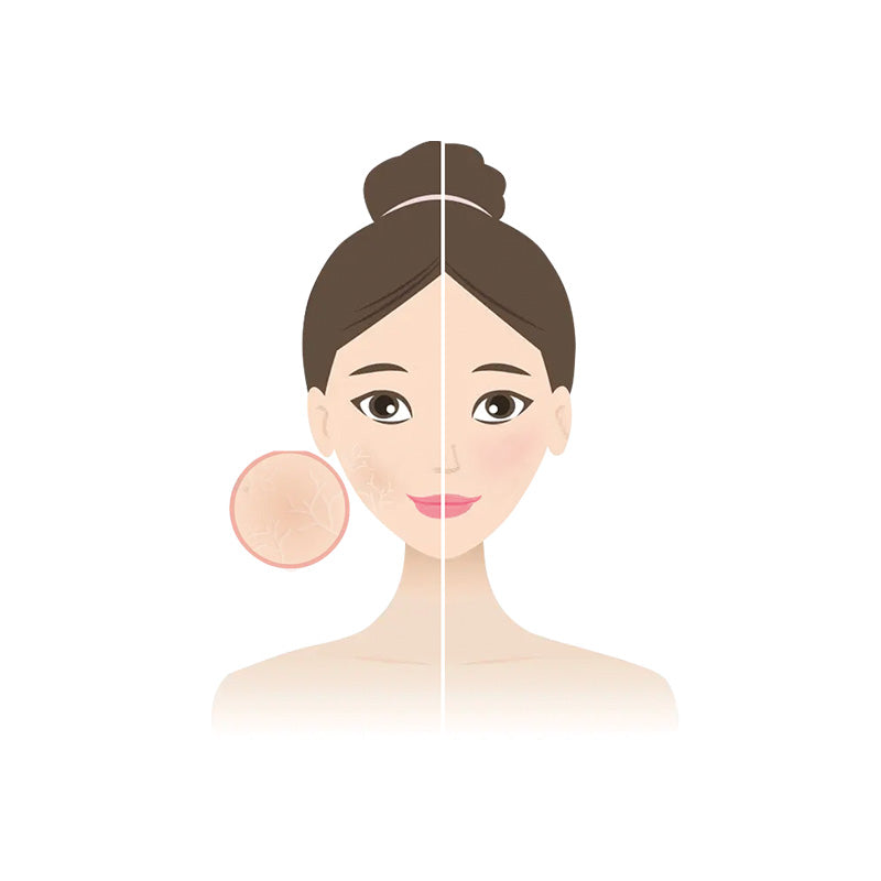 DRY SKIN