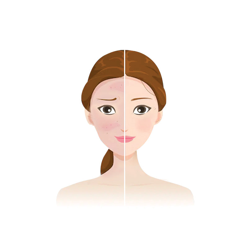 SENSITIVE SKIN