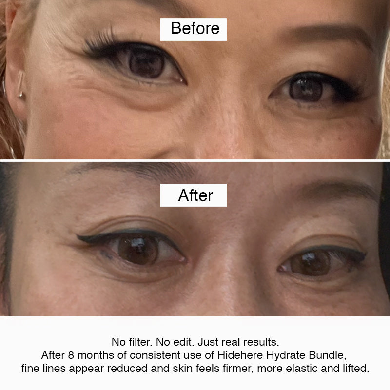 Hyaluronic Eye Cream